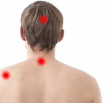 Bouche de l'ostéocondrose